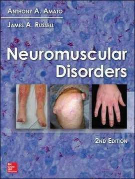 Neuromuscular Disorders, 2Nd Edition