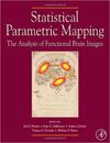 STATISTICAL PARAMETRIC MAPPING: THE ANALYSIS OF FUNCTIONAL BRAIN IMAGES. (2006)