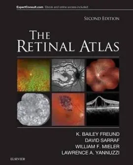 The Retinal Atlas (2ª Ed. )