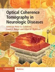 Optical Coherence Tomography In Neurologic Diseases (Julio-15)