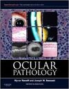 OCULAR PATHOLOGY