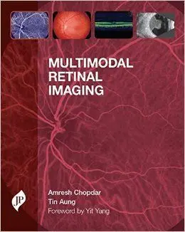 Multimodal Retinal Imaging
