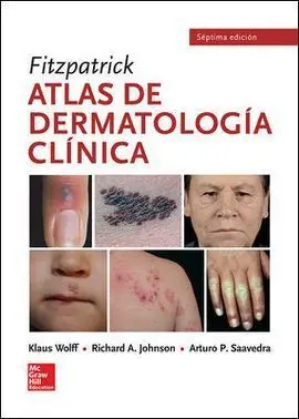 Fitzpatrick. Atlas de Dermatología Clínica