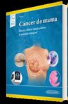 CANCER DE MAMA