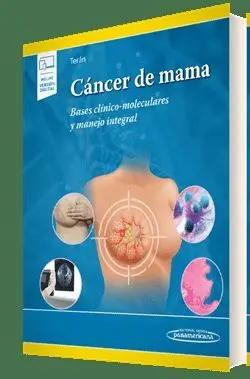 Cancer de Mama