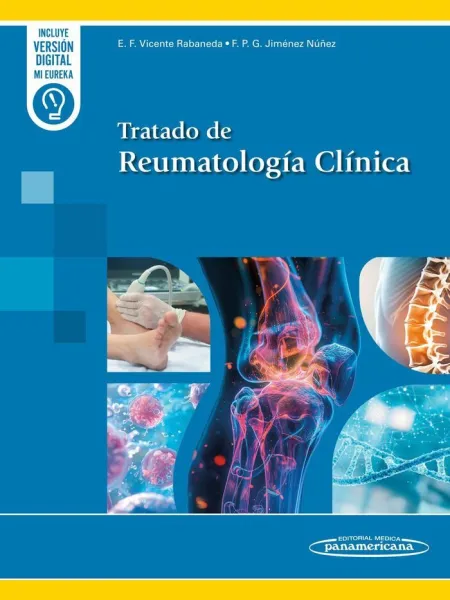Tratado de Reumatología Clínica