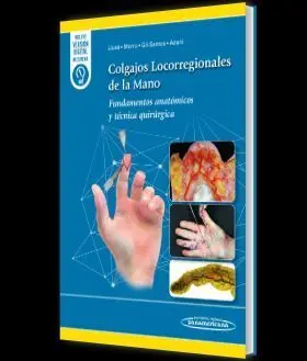 Colgajos Locorregionales de la Mano