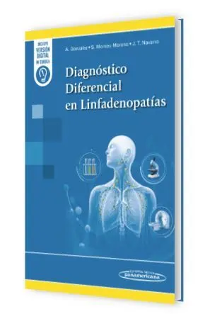 Diagnostico Diferencial en Linfadenopatias