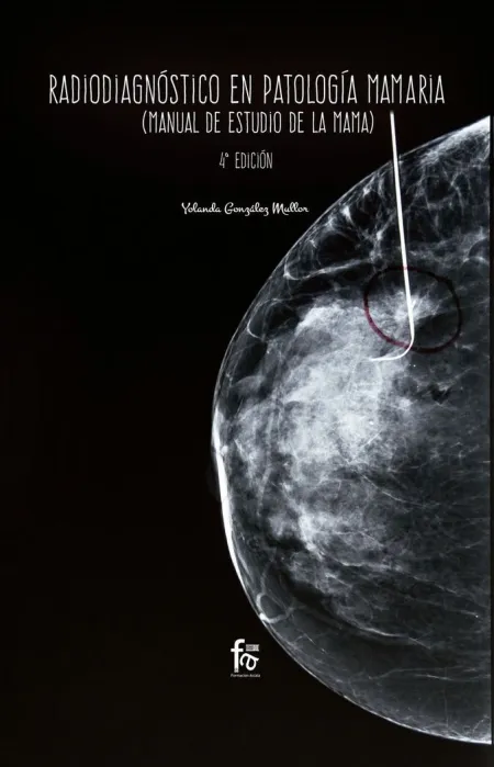 Radiodiagnostico en Patologia Mamaria 4ªed