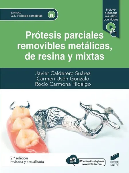Prótesis Parciales Removibles Metálicas, de Resina y Mixta (2ª Edición Revisada