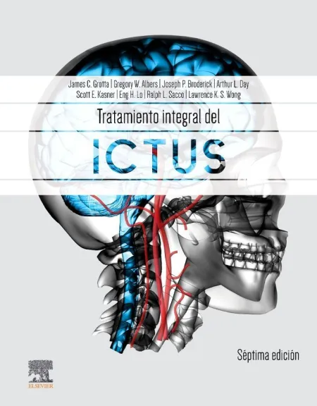 Tratamiento Integral del Ictus (7ªedi. )