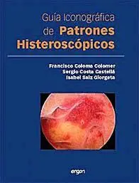 Guía Iconográfica de Patrones Histeroscópicos