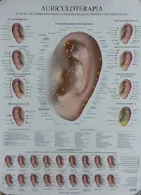 Láminas. Auriculoterapia