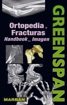 Ortopedia y Fracturas. Handbook en Imagen