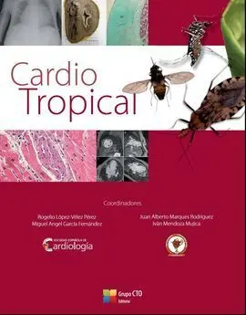 Cardio Tropical