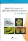 Manual de Restauración del Diente Endodonciado