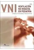 Ventilación no Invasiva en Pediatría