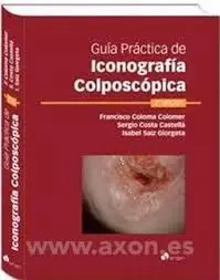Guía Práctica de Iconografía Colposcópica