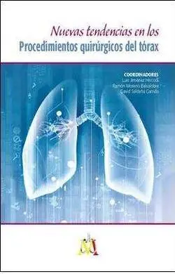 Nuevas Tendencias en los Procedimientos Quirúrgicos del Tórax