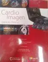 Cardio Imagen para el Clinico