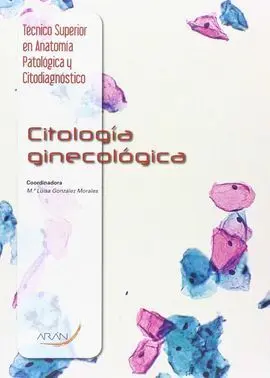 Citología Ginecológica