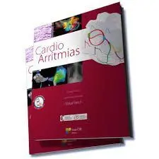 Cardio Arritmias
