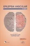 Epilepsia Vascular. 2ª Ed.