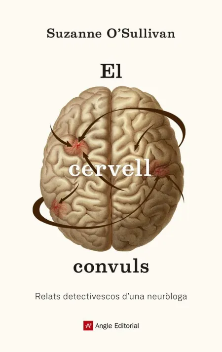 Cervell Convuls,El