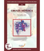 Cirugía Hepática