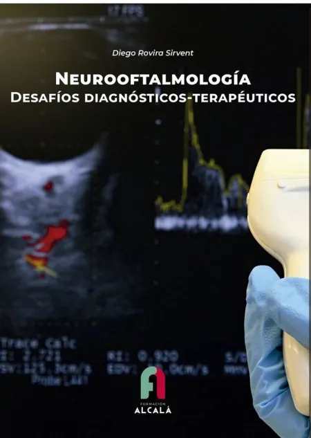 Neurooftalmologia - Desafios Diafnosticos-Terapeut