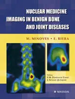 Nuclear Medicine Imaging In Benign Bone And Joint Diseases