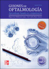 GUIONES DE OFTALMOLOGIA