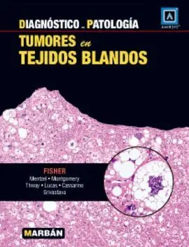 Diagnóstico en Patología. Tumores en Tejidos Blandos