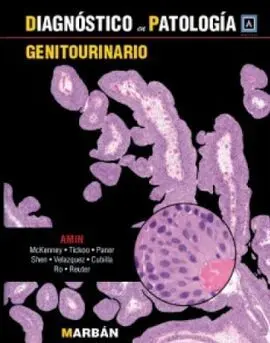 Diagnóstico en Patología. Genitourinario
