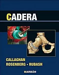 Cadera