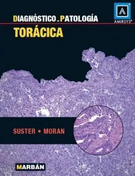 Diagnóstico en Patología. Torácica