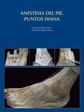 Anestesia del Pie. puntos Diana
