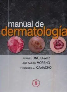 Manual de Dermatología