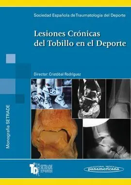 Lesiones Crónicas del Tobillo en el Deporte