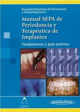 Manual Sepa de Periodoncia y Terapéutica de Implantes