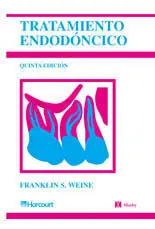 Tratamiento Endodóncico