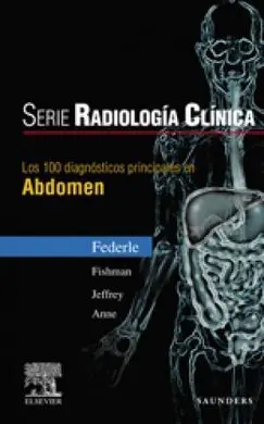 Los 100 Diagnósticos Principales en Abdomen