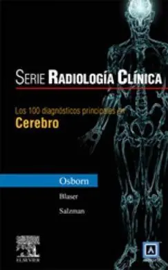 Los 100 Diagnosticos Prinipales en el Cerebro