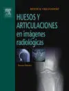 Huesos y Articulaciones en Imágenes Radiológicas