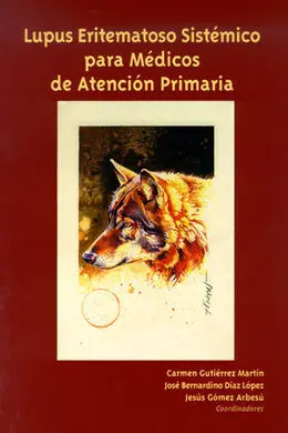 Lupus Eritematoso Sistémico para Médicos de Atención Primaria