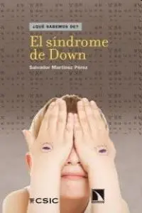 El Síndrome de Down