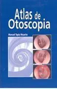 Atlas de Otoscopía