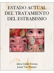 Estado Actual del Tratamiento del Estrabismo