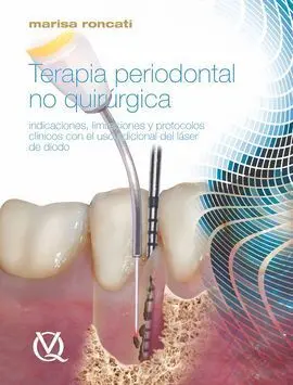 Terapia Periodontal no Quirúrgica