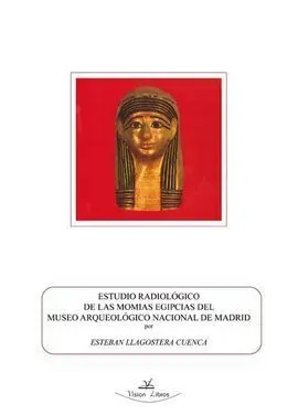 Estudio Radiológico de las Momias Egipcias del Museo Arqueológico Nacional de Ma
